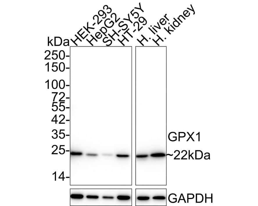 Glutathione Peroxidase 1/GPX1 Antibody (C5-A10-R)