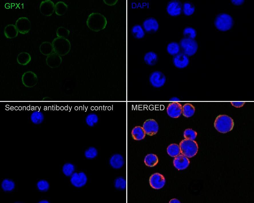 Glutathione Peroxidase 1/GPX1 Antibody (C5-A10-R)