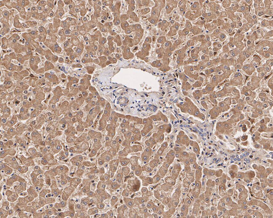 Glutathione Peroxidase 1/GPX1 Antibody (C5-A10-R)