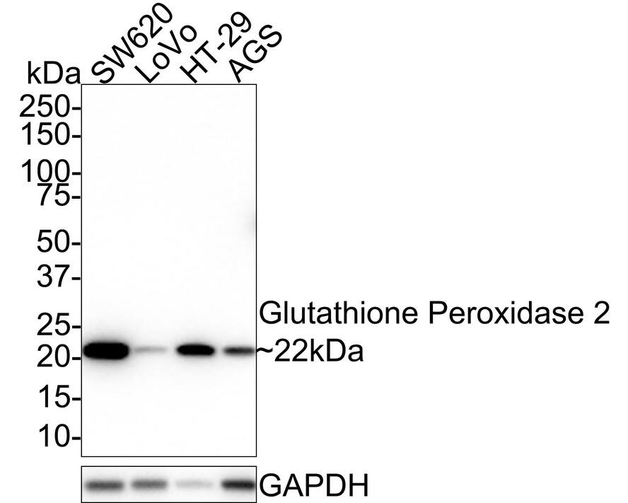 Glutathione Peroxidase 2/GPX2 Antibody (JE40-73)