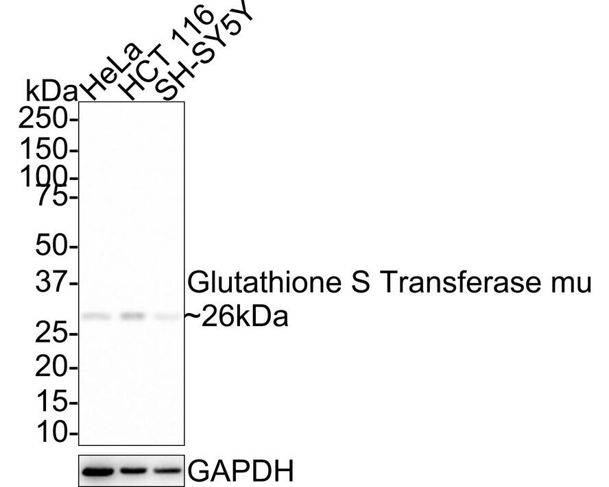 Glutathione S-Transferase mu 1/GSTM1 Antibody (JE36-67)