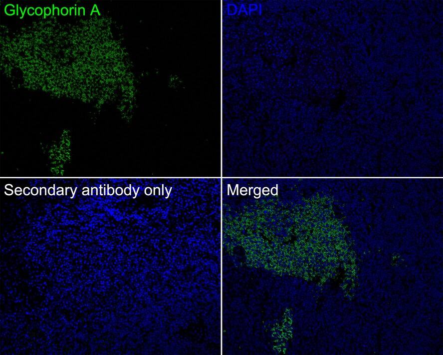 Glycophorin A Antibody (JE32-24)