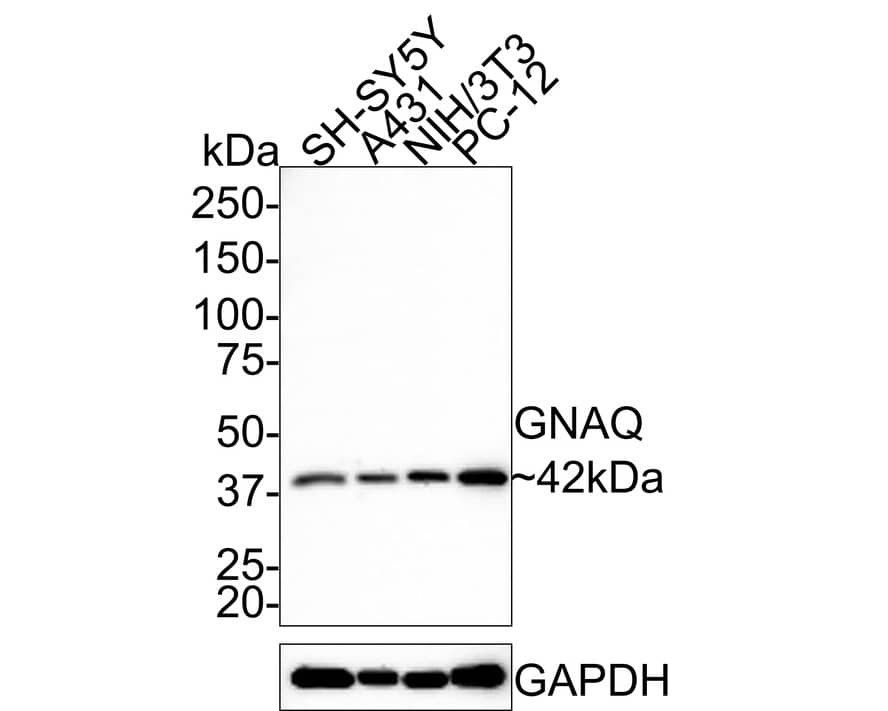 GNAQ Antibody (JE65-59)