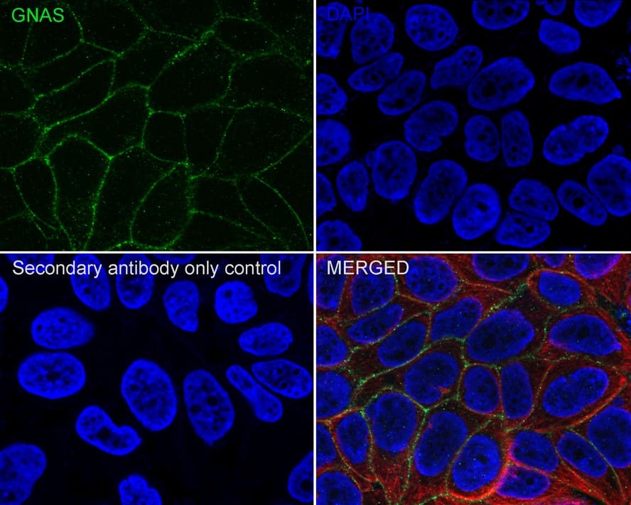 G protein alpha Antibody (A8F11-R)