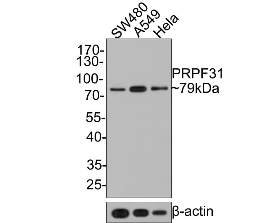 N-Acetylmannosamine Kinase/GNE Antibody (JE64-81)