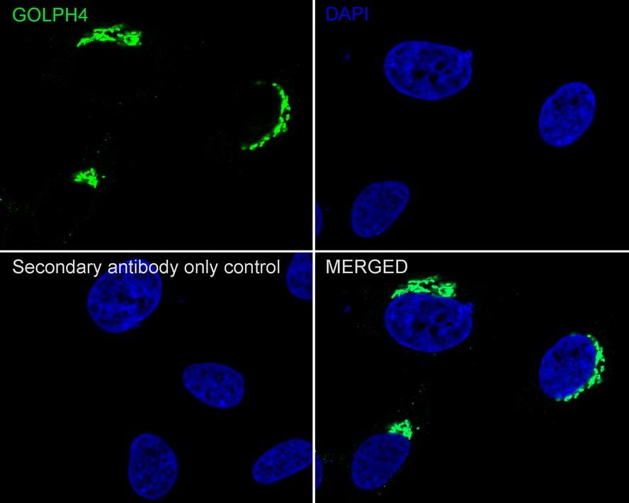 GOLPH4 Antibody (PSH02-98)