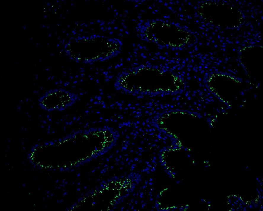 GOLPH4 Antibody (PSH02-98)