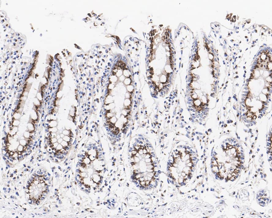 GOLPH4 Antibody (PSH02-98)