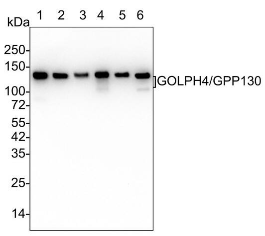 GOLPH4 Antibody (PSH02-98)