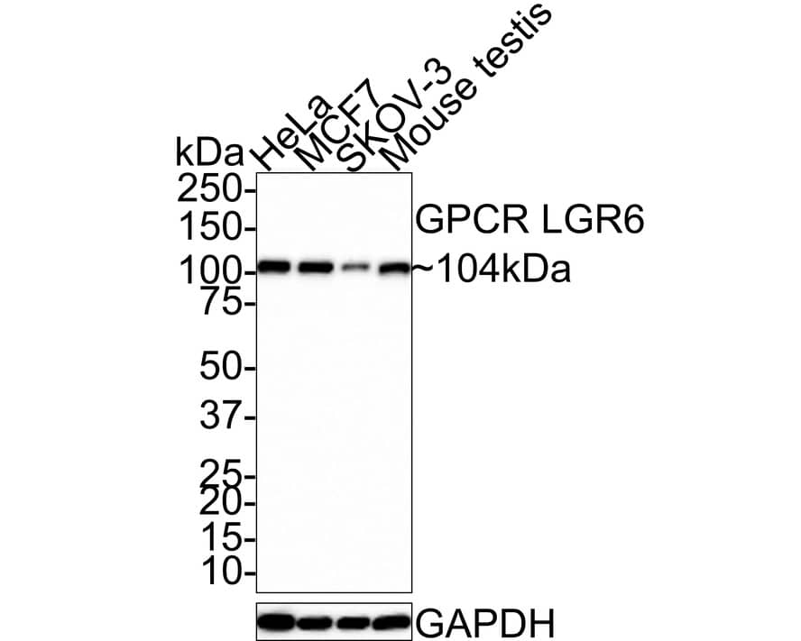 Lgr6 Antibody (JE39-78)