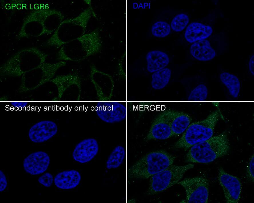 Lgr6 Antibody (JE39-78)