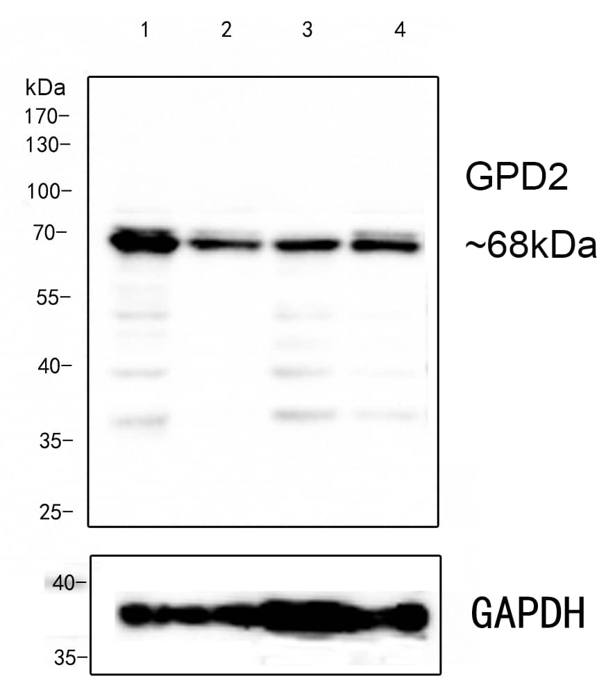 GPD2 Antibody (PSH0-31)