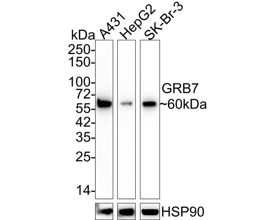 GRB7 Antibody (JE50-05) Western Blot: GRB7 Antibody (JE50-05) [NBP3-32404]
