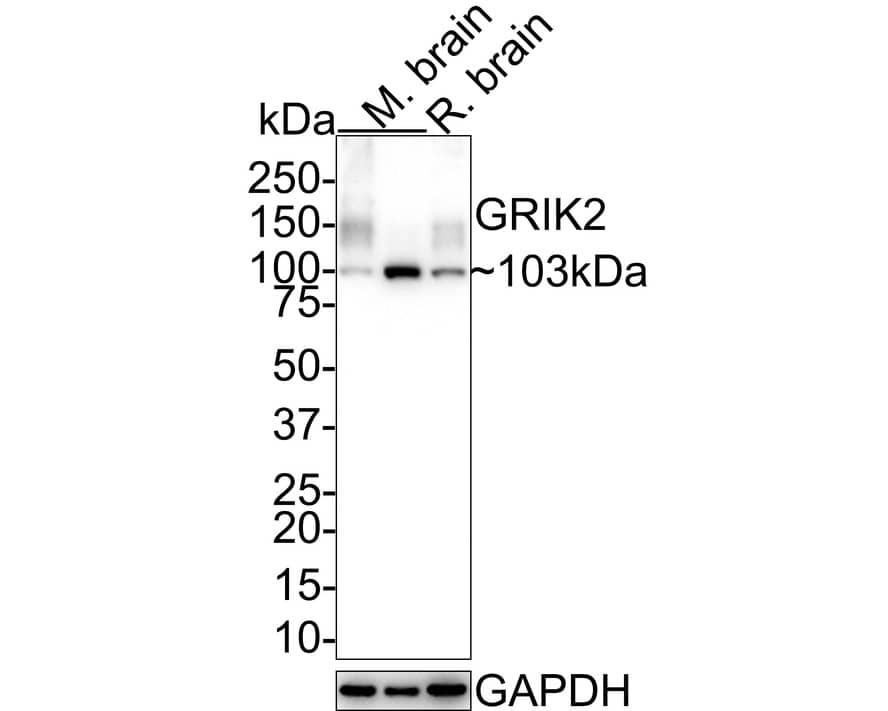 Glutamate Receptor 6 Antibody (JE39-33)