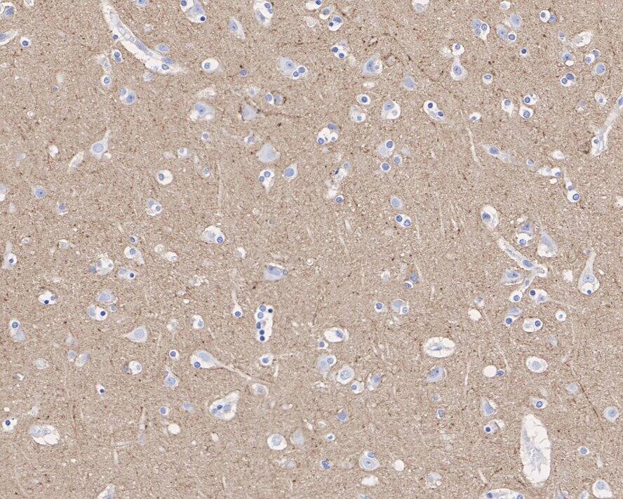Glutamate Receptor 6 Antibody (JE39-33)