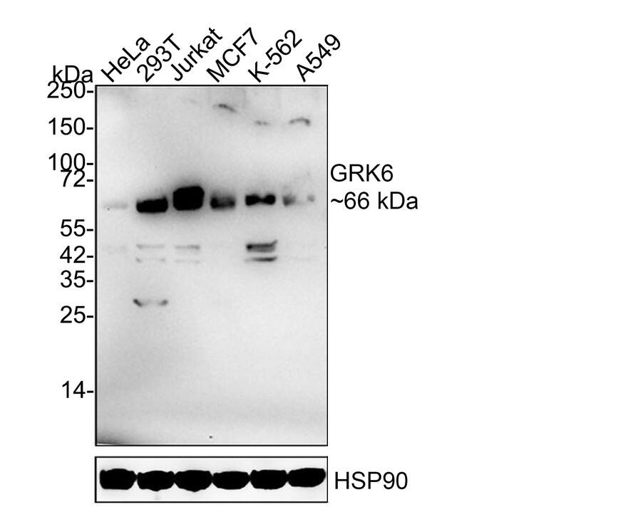 GRK6 Antibody (JE63-06)