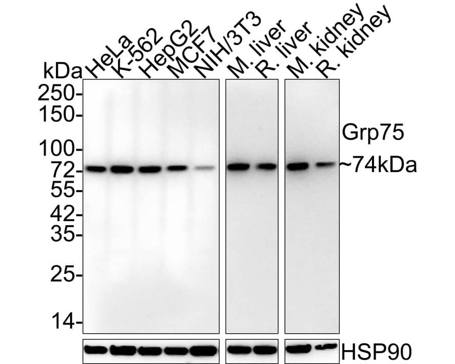 GRP75/HSPA9B/Mortalin Antibody (6-A9-R)