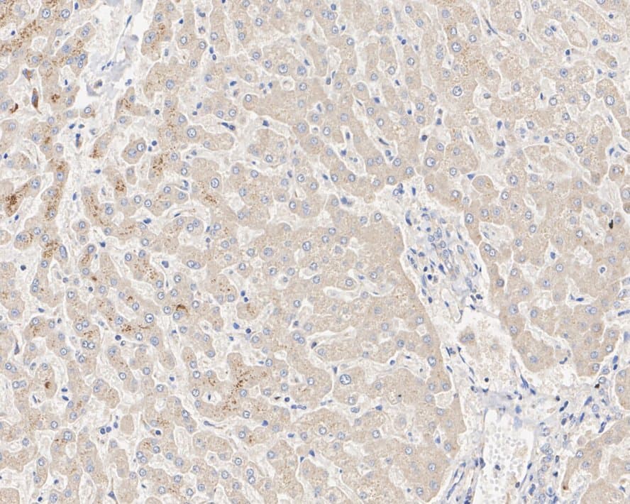 GRP75/HSPA9B/Mortalin Antibody (6-A9-R)