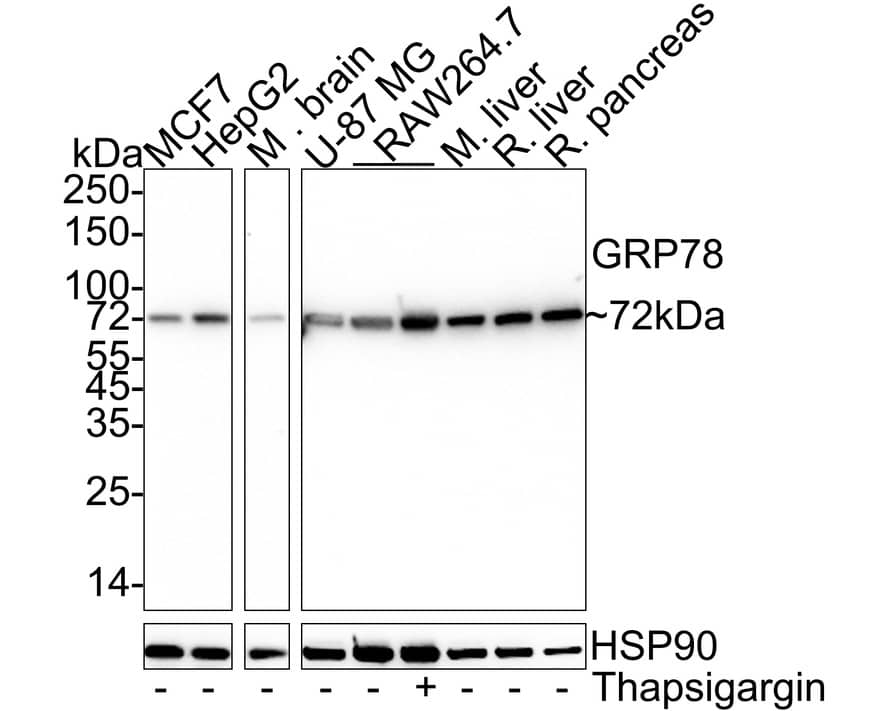 GRP78/HSPA5 Antibody (C9-9-R)