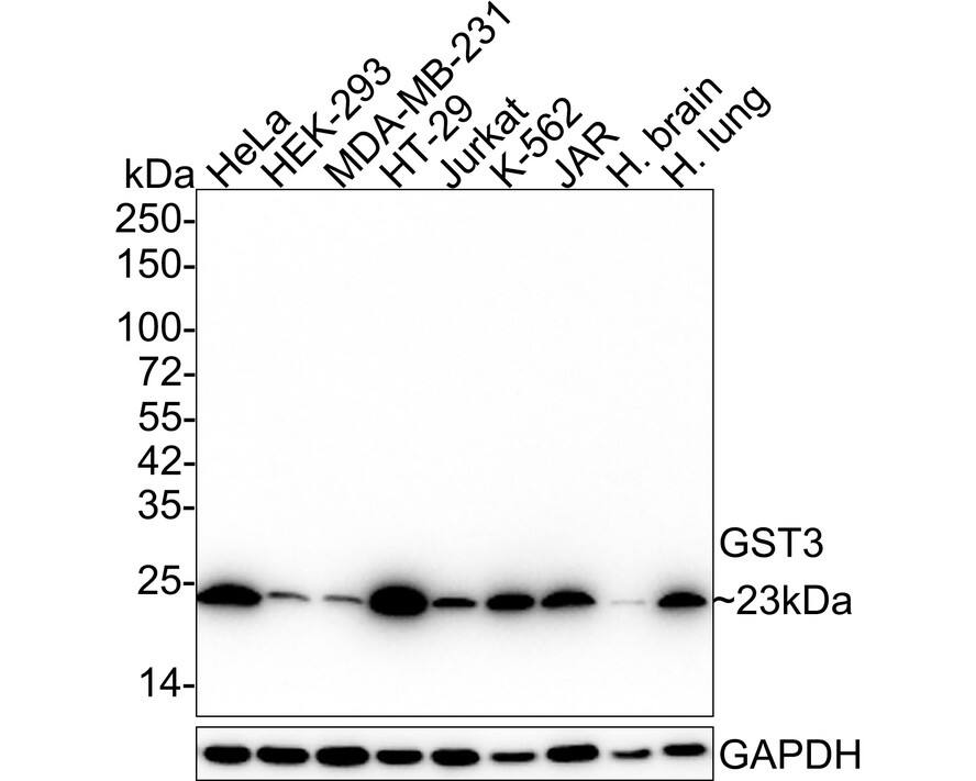 Glutathione S-Transferase pi 1/GSTP1 Antibody (11D5-R) Western Blot: Glutathione S-Transferase pi 1/GSTP1 Antibody (11D5-R) [NBP3-32411]