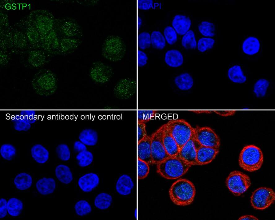 Glutathione S-Transferase pi 1/GSTP1 Antibody (11D5-R)