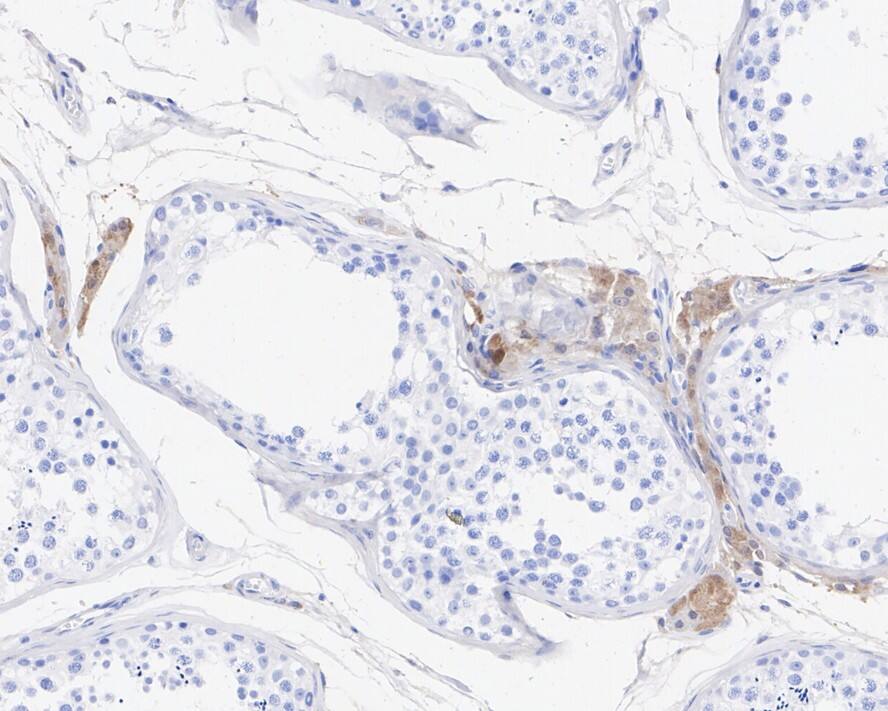 Glutathione S-Transferase pi 1/GSTP1 Antibody (11D5-R)