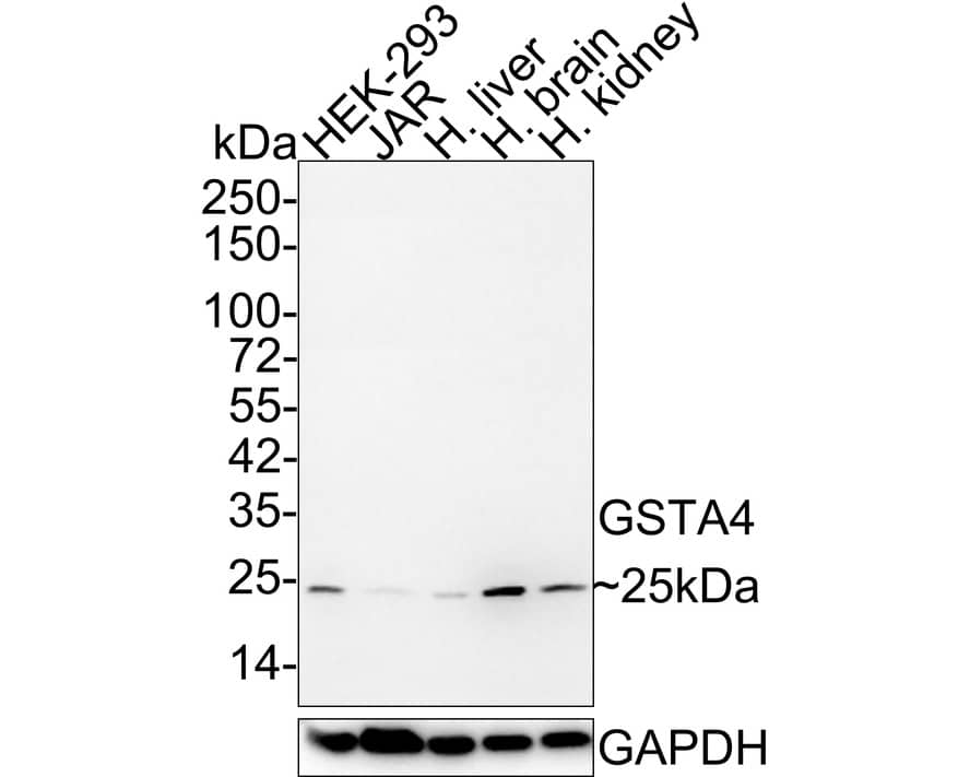 GSTA4 Antibody (JE61-65)