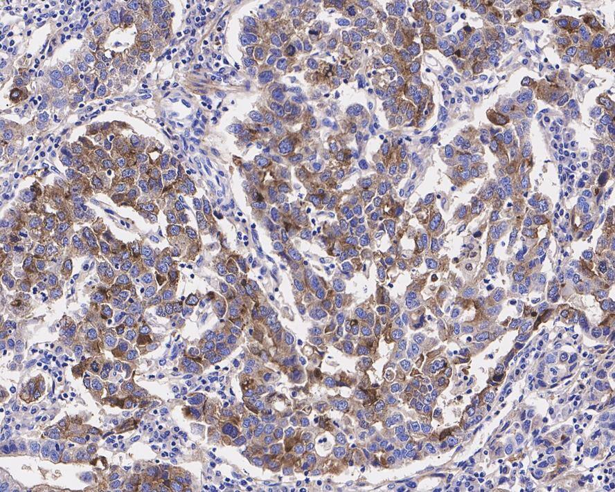 HRAS Antibody (JE42-15)
