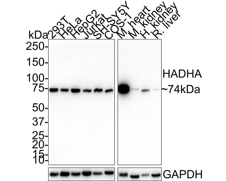 HADHA Antibody (PSH01-28)