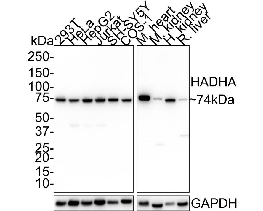 HADHA Antibody (PSH01-29)