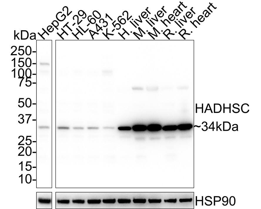 HADH Antibody (D10-E7-R)