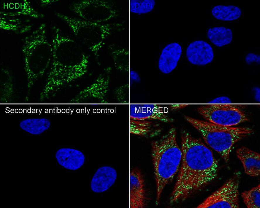 HADH Antibody (D10-E7-R)