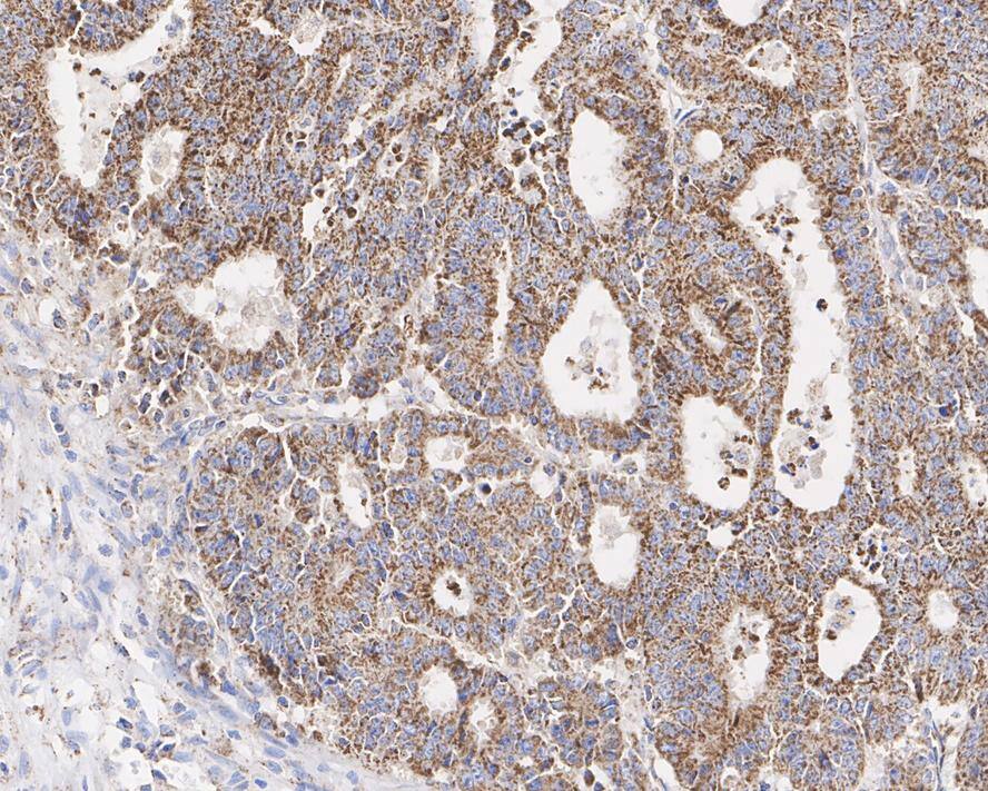 HADH Antibody (D10-E7-R)