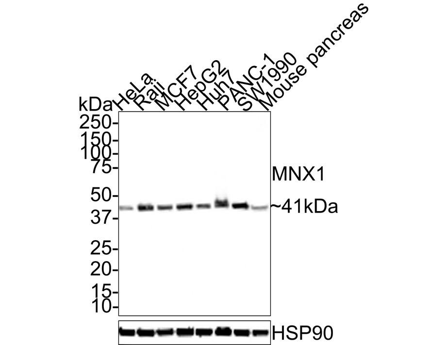 MNX1/HLXB9 Antibody (JE32-08)