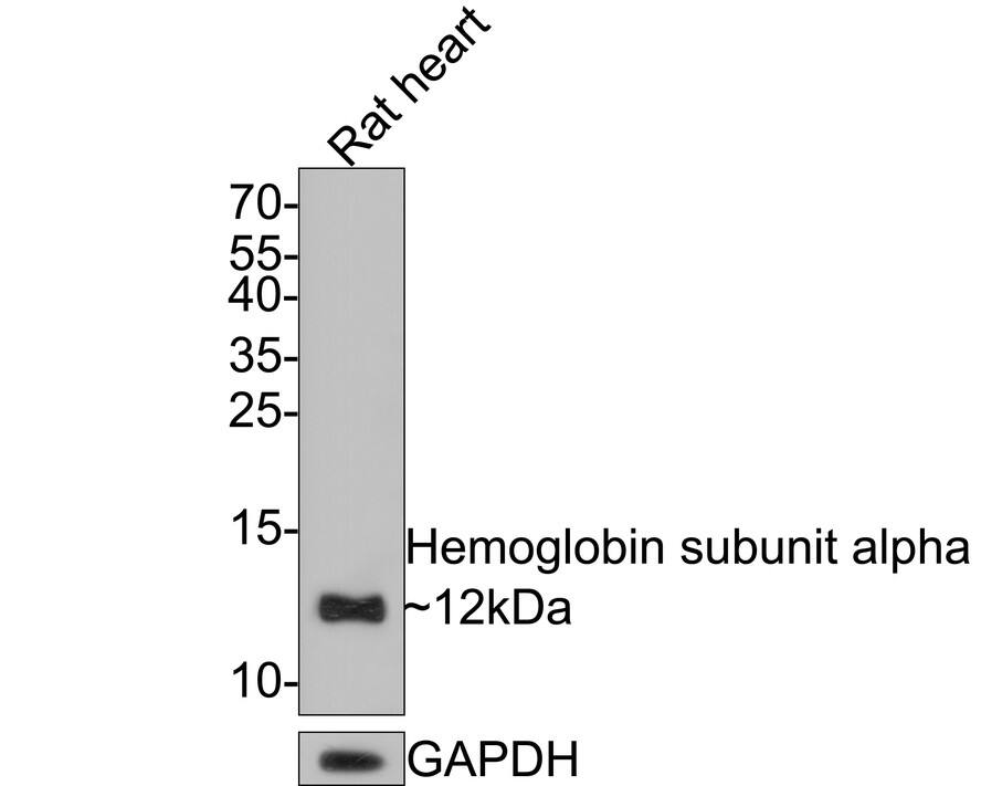 Hemoglobin alpha Antibody (PD00-16)