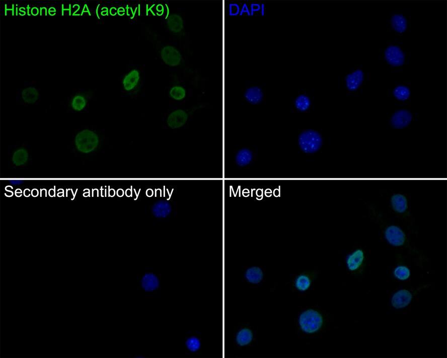 Histone H2a [ac Lys9] Antibody (PS01-45)