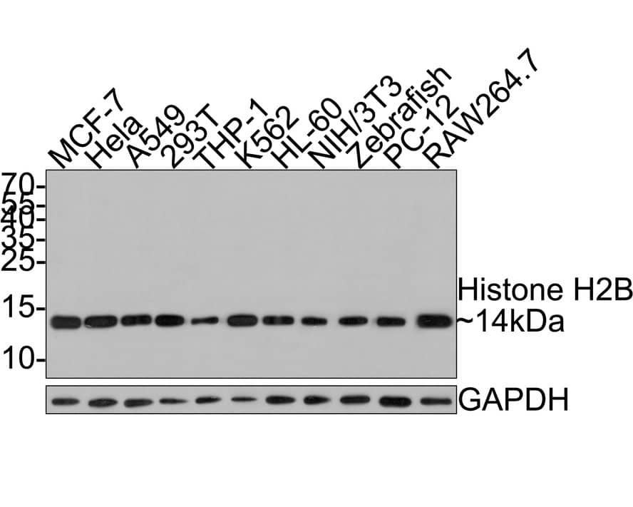 Histone H2B Antibody