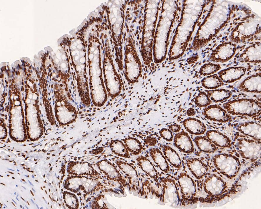 Histone H2B Antibody