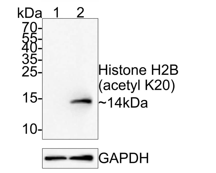 Histone H2B [ac Lys20] Antibody (PS01-46)