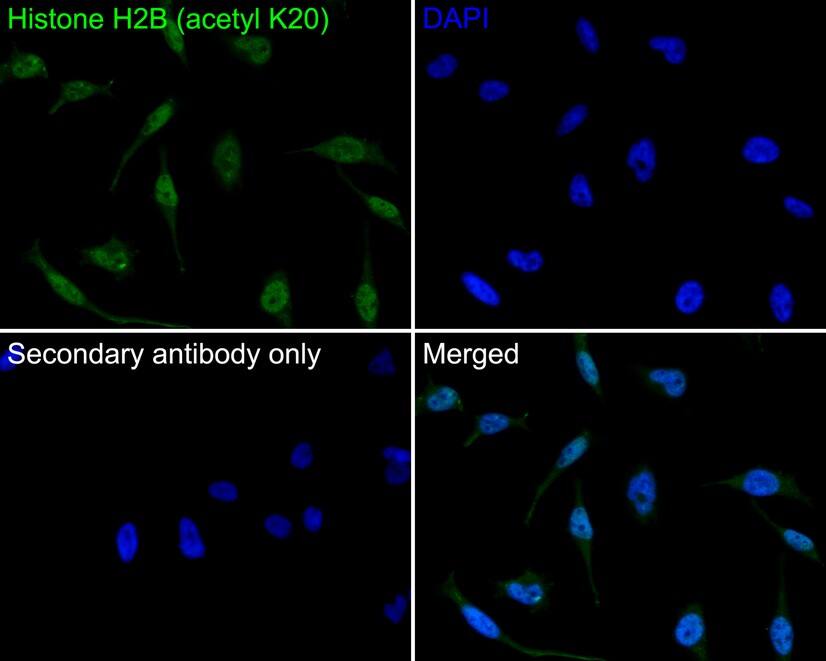 Histone H2B [ac Lys20] Antibody (PS01-46)
