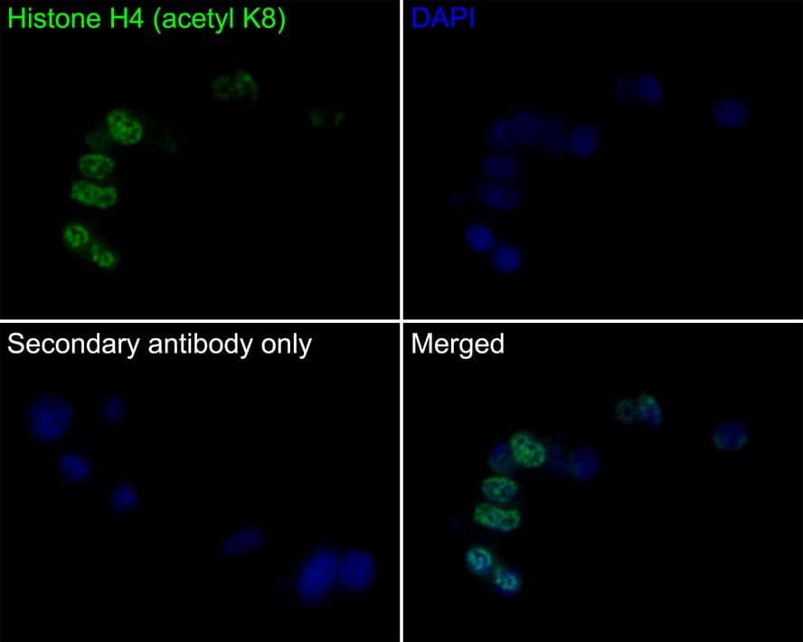 Histone H4 [ac Lys8] Antibody (PS01-25)