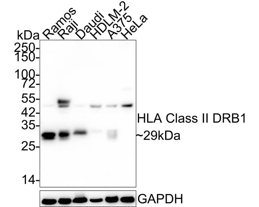 HLA DRB1 Antibody (JE60-43)