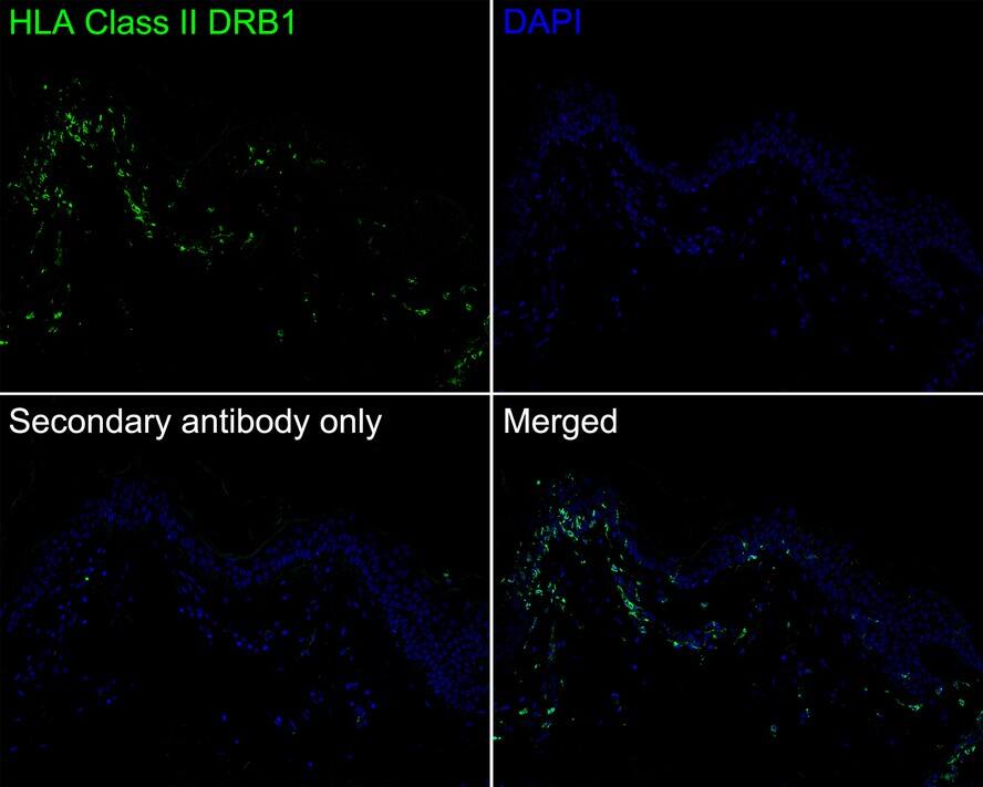 HLA DRB1 Antibody (JE60-43)