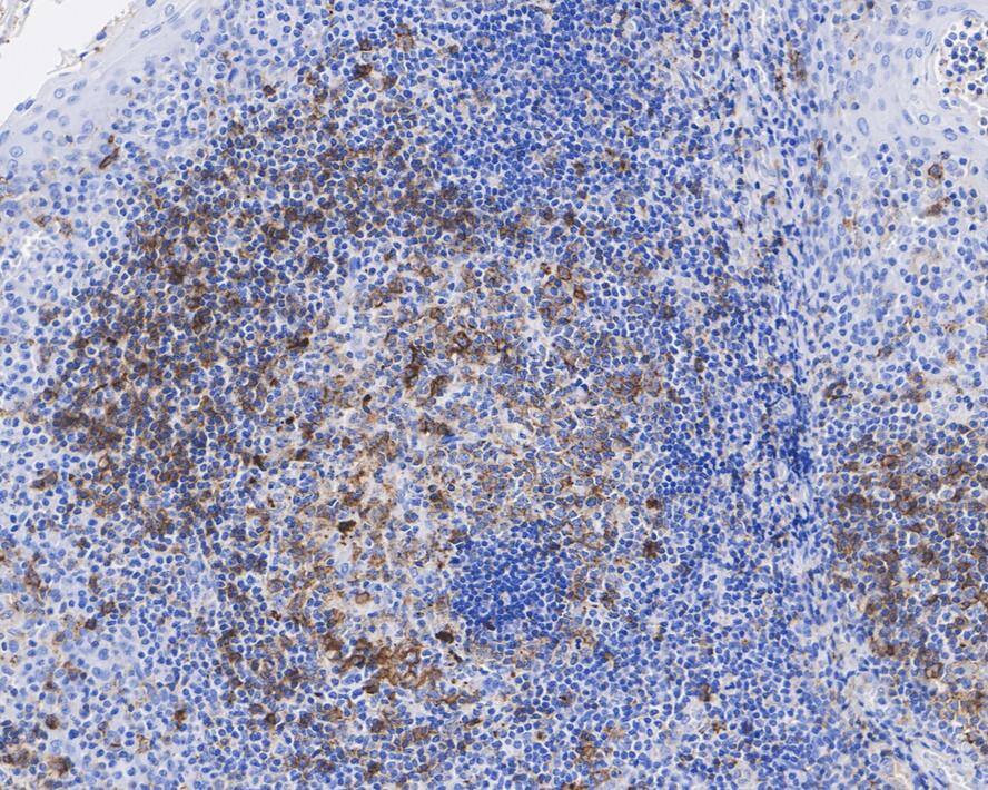 HLA DRB1 Antibody (JE60-43)