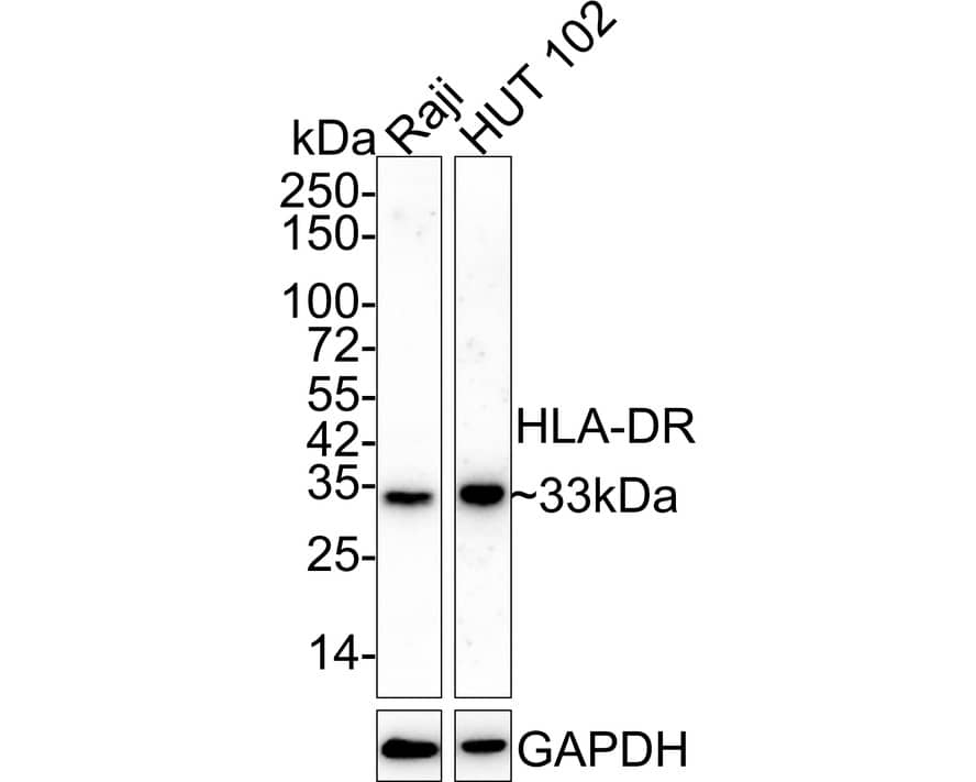 HLA-DR Antibody (10-D8-R)