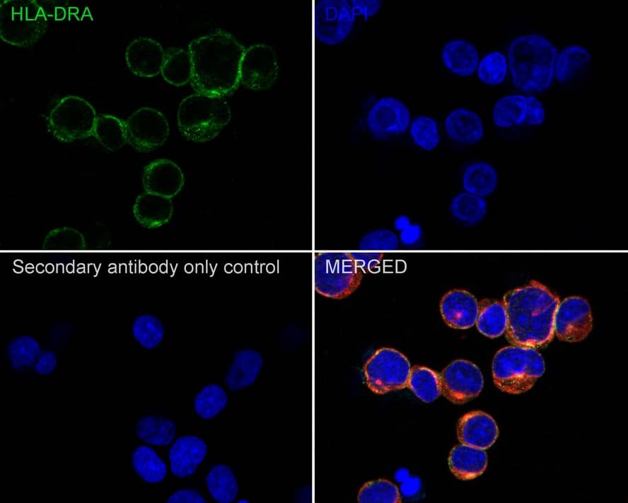 HLA-DR Antibody (10-D8-R)
