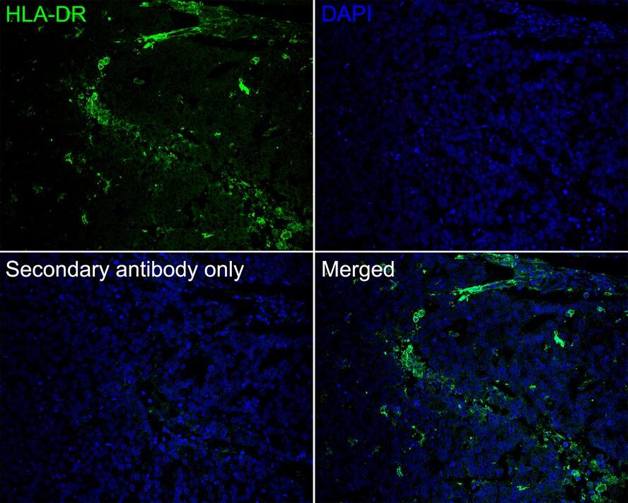 HLA-DR Antibody (10-D8-R)