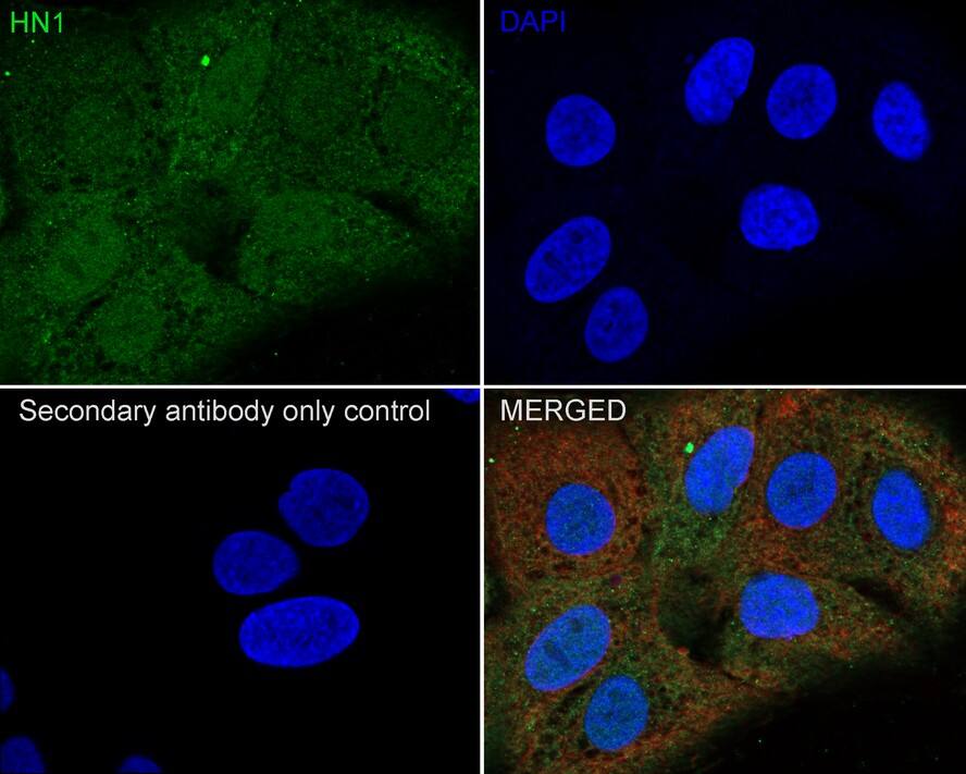 HN1 Antibody (JE55-74)