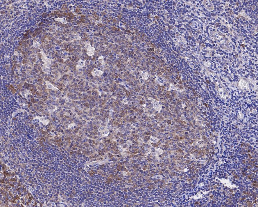 HN1 Antibody (JE55-74)