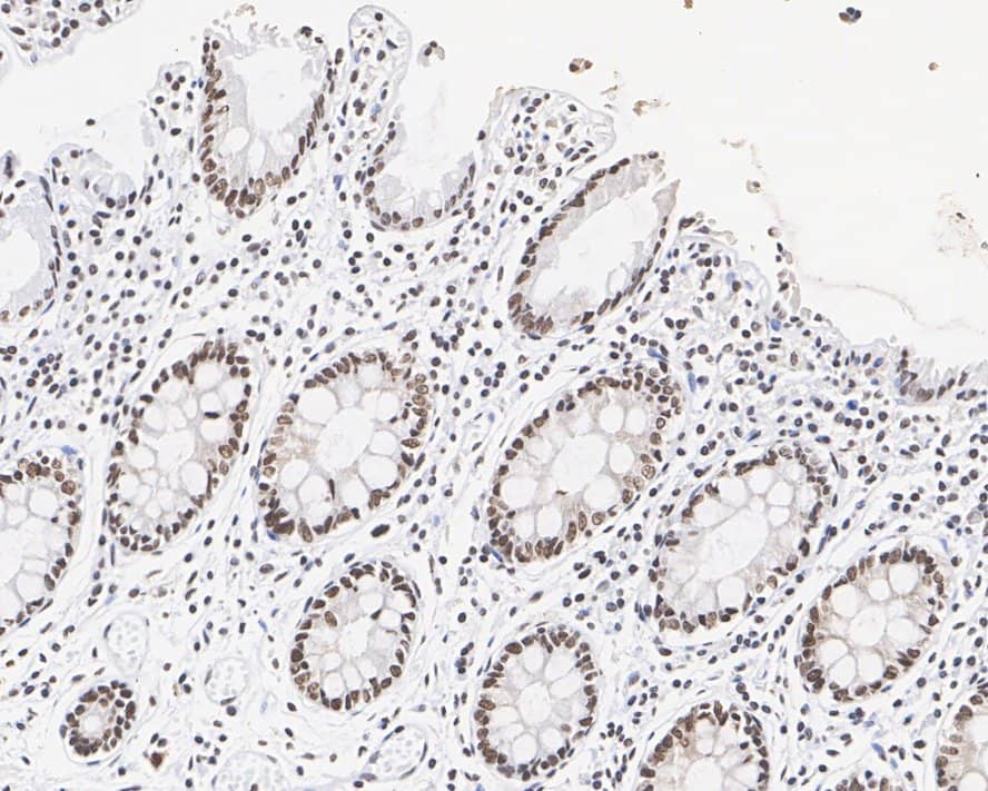 HNRNPA0 Antibody (PSH02-77)